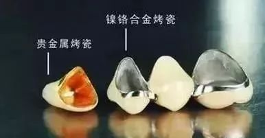 心脏核磁共振能做烤瓷牙吗,做核磁共振嘴里有金属牙能做吗