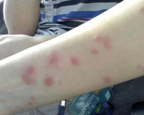 用什么方式灭蚊子,灭蚊子最有效的土方法