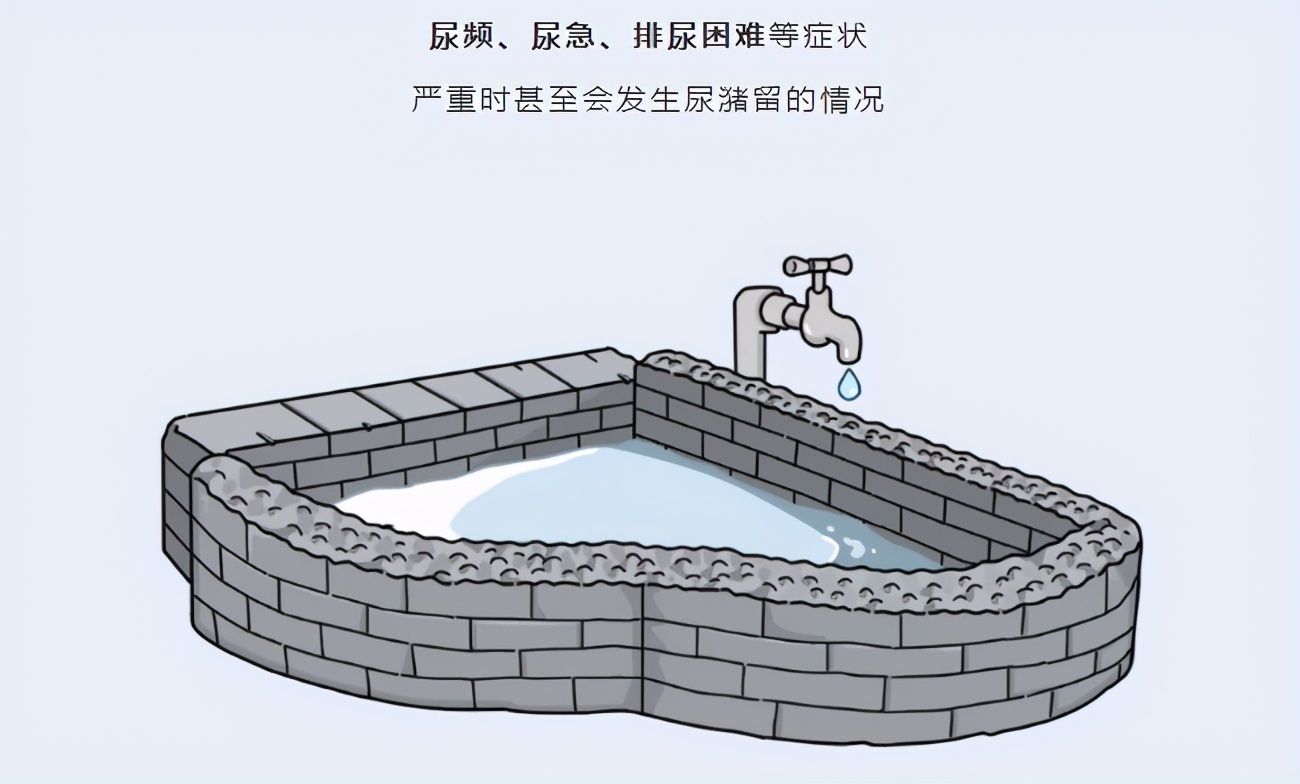 前列腺炎前列腺增生怎么检查,前列腺增生和前列腺炎怎么检查