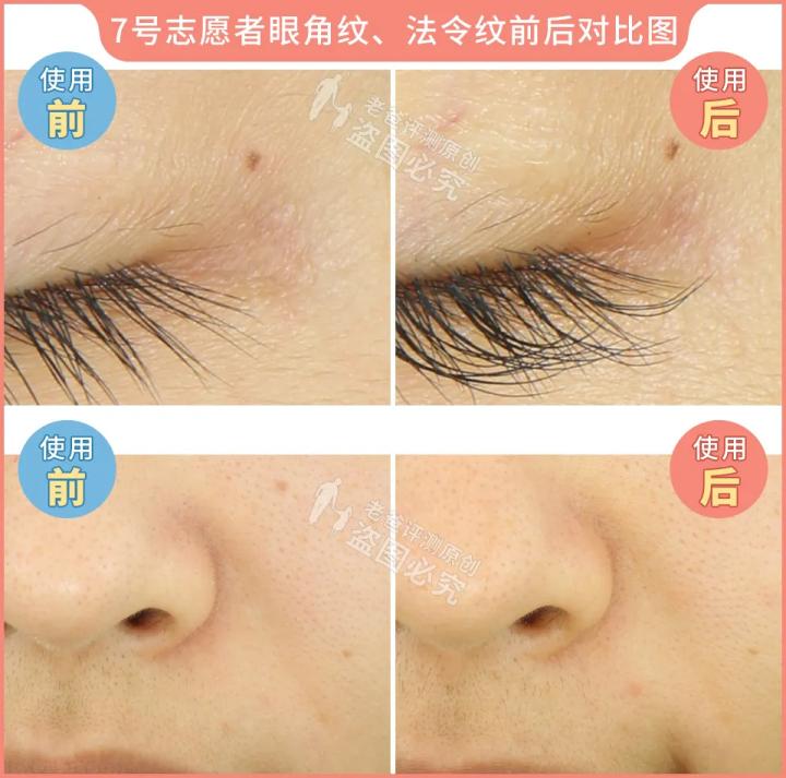 300块的网红美容仪有效果吗,网红家用美容仪测评