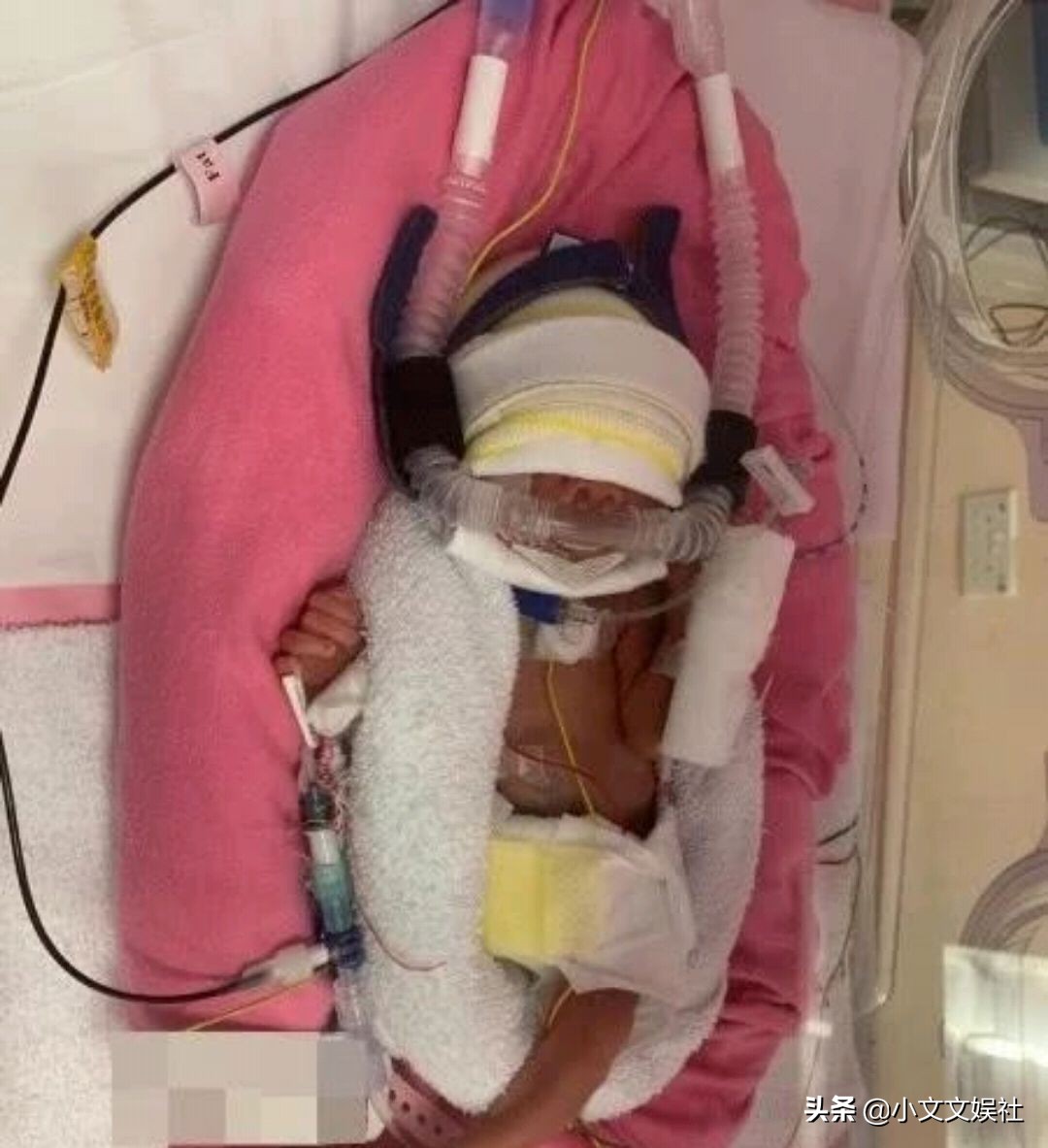 他最穷时全身只有9块钱，曾自曝女儿早产脑出血，如今终否极泰来