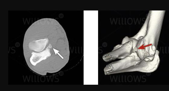 软骨病站立不起来怎么回事,小狗狗髋关节有问题不会站立