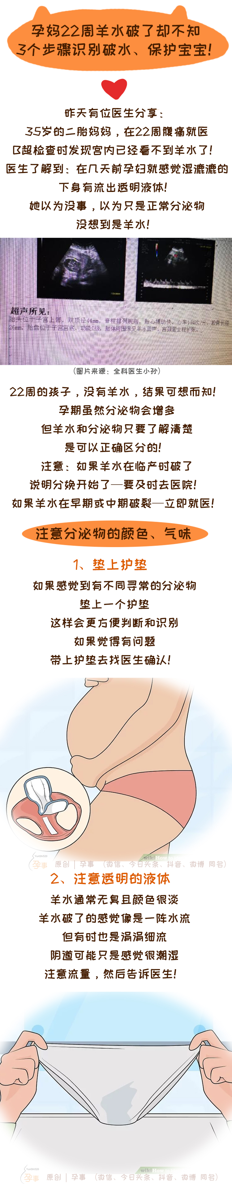 孕妈破水应该注意什么事项,孕22周高位破水能保住吗