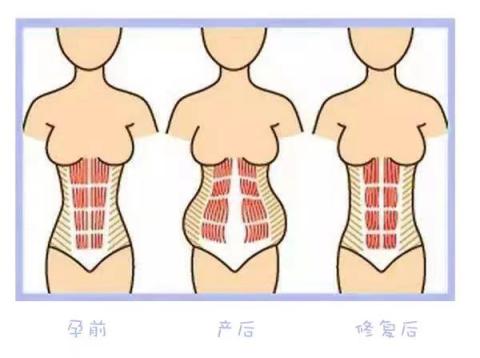 产后恢复必做的六件事,产后恢复必备100个知识