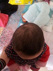 宝宝的头睡偏了怎么补救,宝宝头睡偏了怎么纠正最好