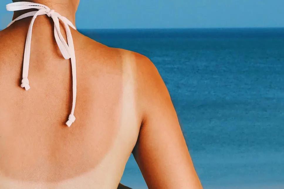 晒黑了吃什么变白更快,晒黑了吃什么可以快速的变白