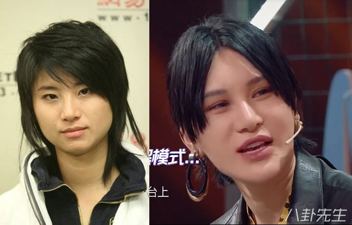 各届超女整容,2015年超女整容失败新闻案例