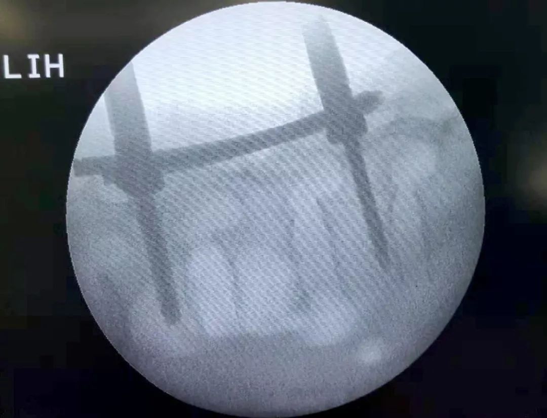 锦州发明专利,锦州实用新型专利