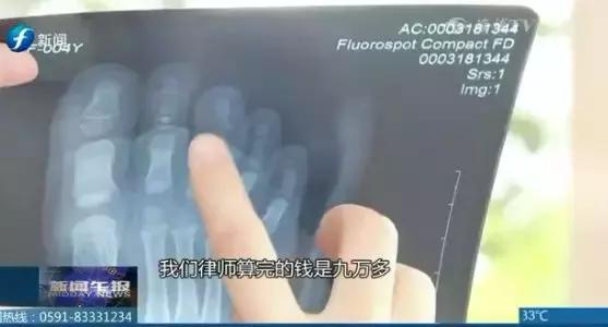 8岁女童被外卖车撞伤,小女孩被外卖员撞后续处理结果