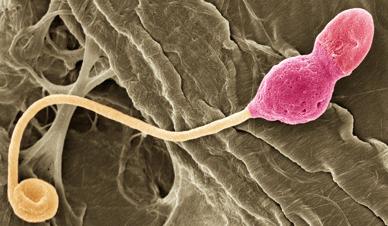 科学家研究精子运动过程，视频显示行动缓慢的毫不留情被淘汰了