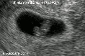 不是开玩笑，我把我家的兔子摸怀孕了...