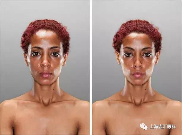 照镜子特别丑照相更丑,照镜子觉得自己好丑