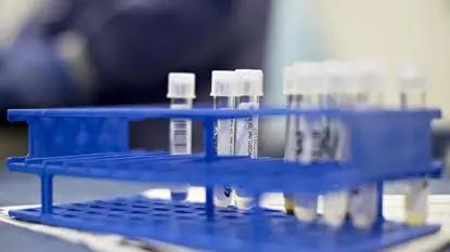 澳洲营养品保健品曝光,澳洲保健品必买的20样