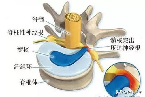 疼痛调理手法,疼痛治疗技巧视频