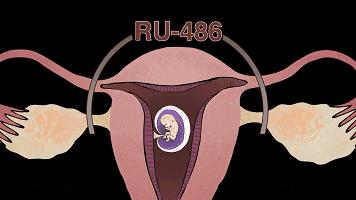 人流最多次案例,20岁女孩人流七次后续