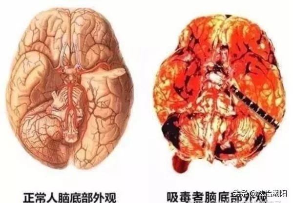 与“性”挂钩的*品毒**，上瘾背后的疯狂！