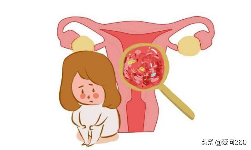 妇科炎症是不是不注意清洁,妇科不注意卫生会引发什么