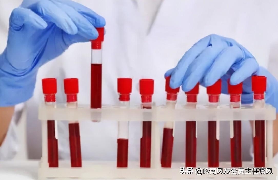 痛风和肌酐高注意事项,肌酐升高的原因痛风