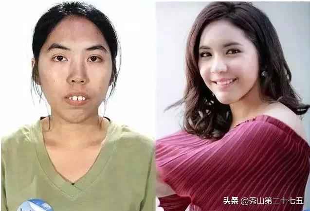 龅牙妹因为丑生活处处受挫，下定决心整容后，人生发生大翻转