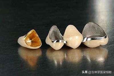 如何选择烤瓷牙牙冠,怎样选烤瓷全冠