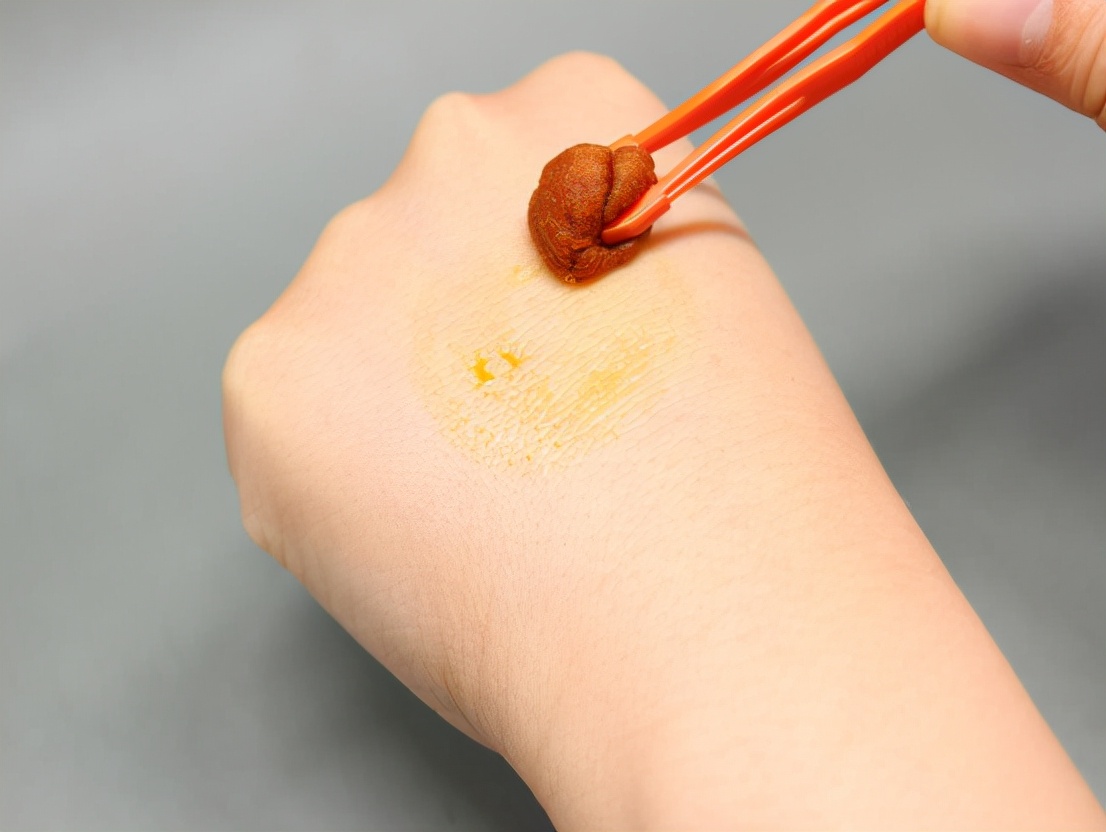 被狗咬伤打疫苗10年后就没事了吗,被狗咬伤打了疫苗还会有潜伏期吗