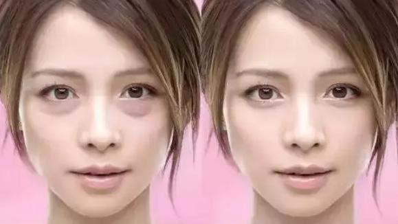 “平价蛇毒眼膜”帮你养出明星同款的超美卧蚕眼！