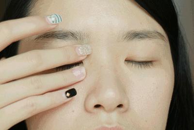 眼周脂肪粒要做什么医美,眼周围的脂肪粒适合用的护肤品