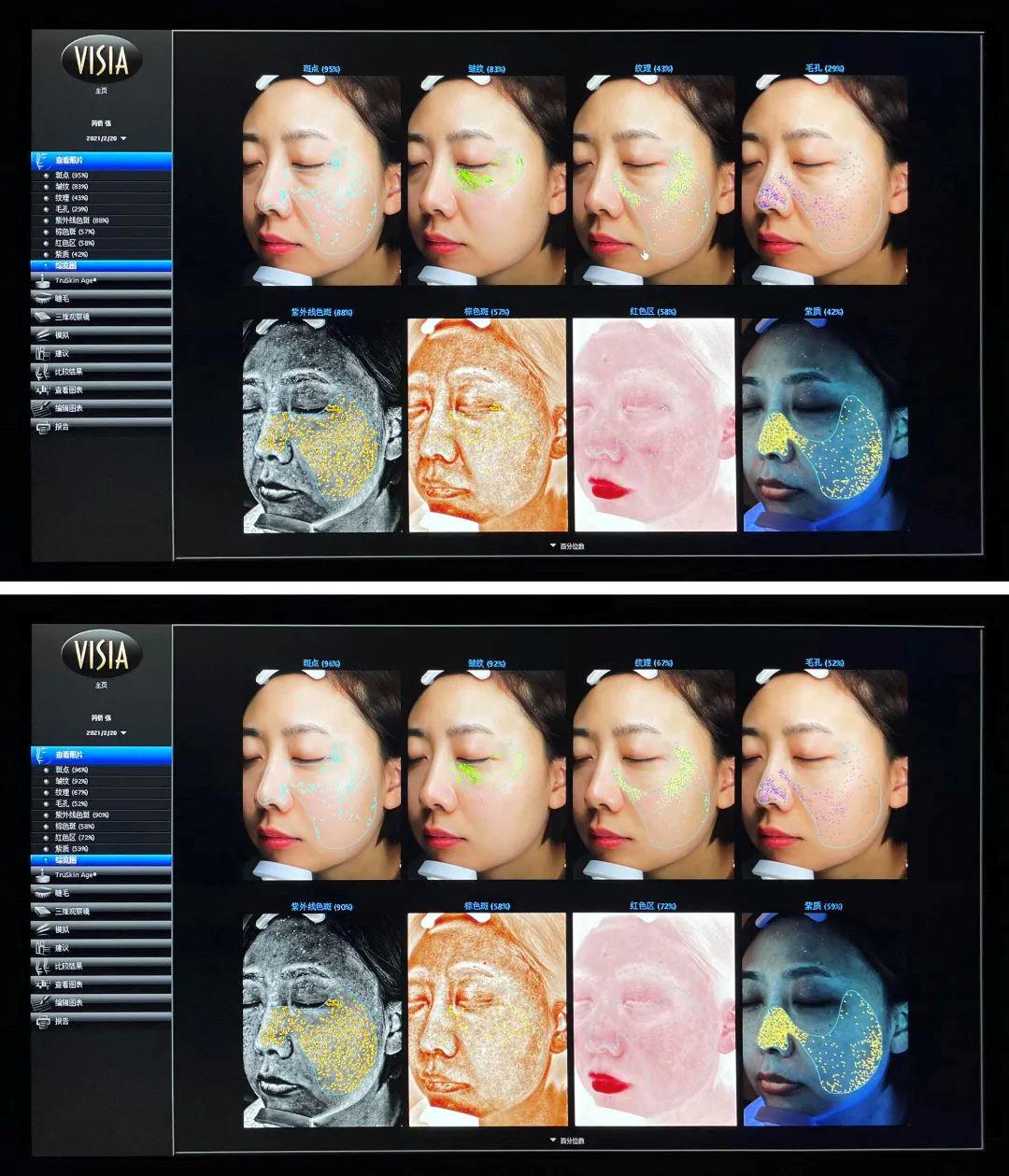 碧欧泉美白祛皱,碧欧泉美白抗老