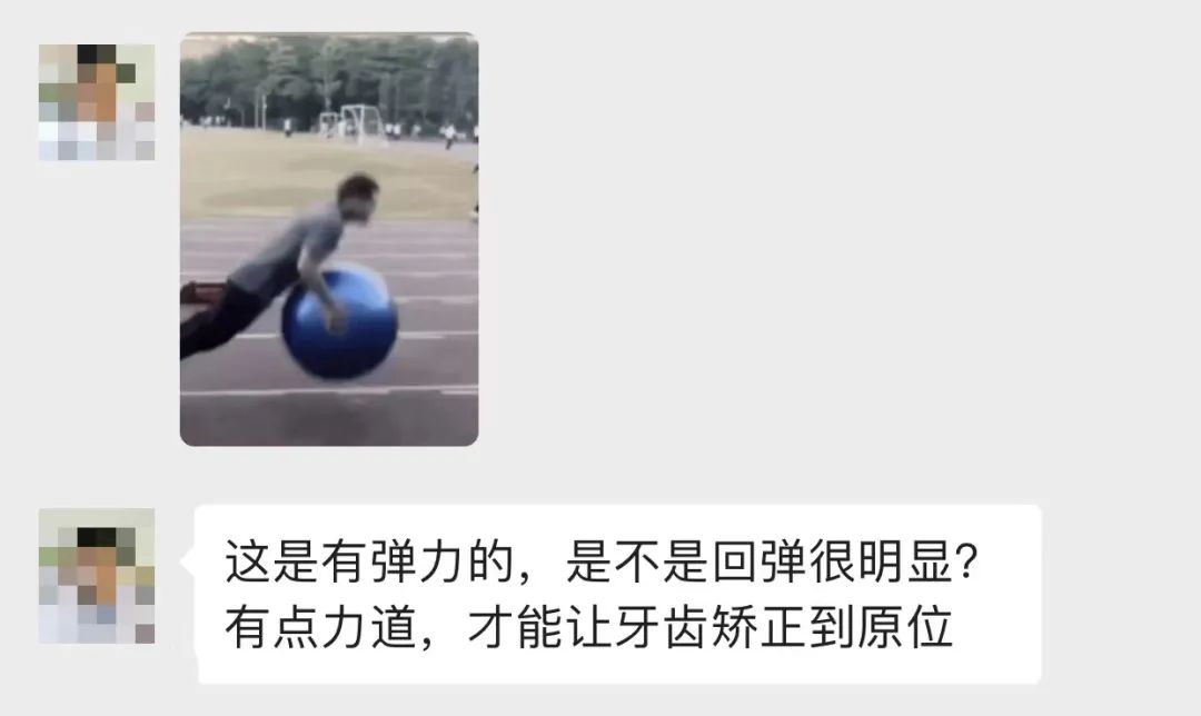 9块9隐形牙套,在家自制透明牙套