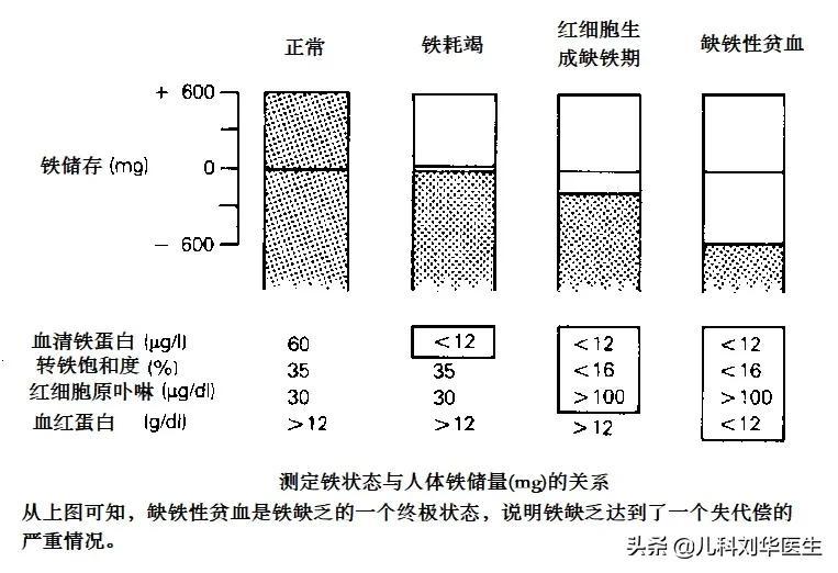 儿童铁缺乏症是缺铁性贫血的几倍,用铁锅炒菜可有效预防缺铁性贫血