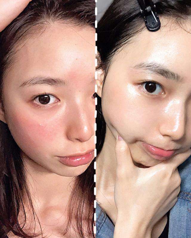 明星都是用什么牌子的美容仪,半个娱乐圈都用美容仪吗