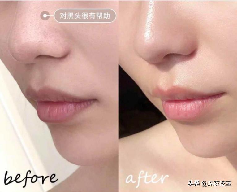 这些牌子护肤品别用小心烂脸,警惕这几款护肤品被列入黑名单