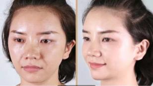 经常敷面膜有什么改善,经常敷面膜皮肤看起来还是很差