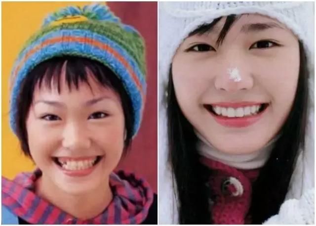 日本整容的鬼斧神工，来见识一下各位日星是整容了还是“长开”了