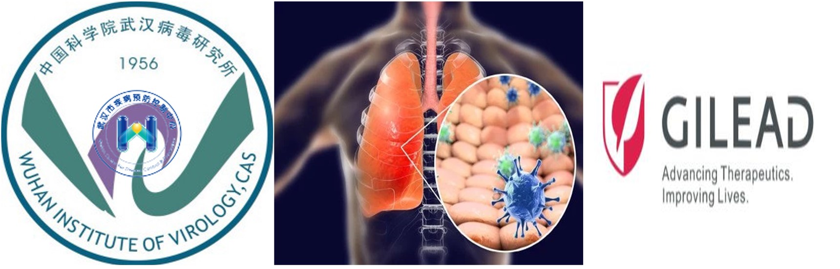 瑞德西韦治新冠病毒新药,抗新冠病毒新药瑞德西韦完成临床