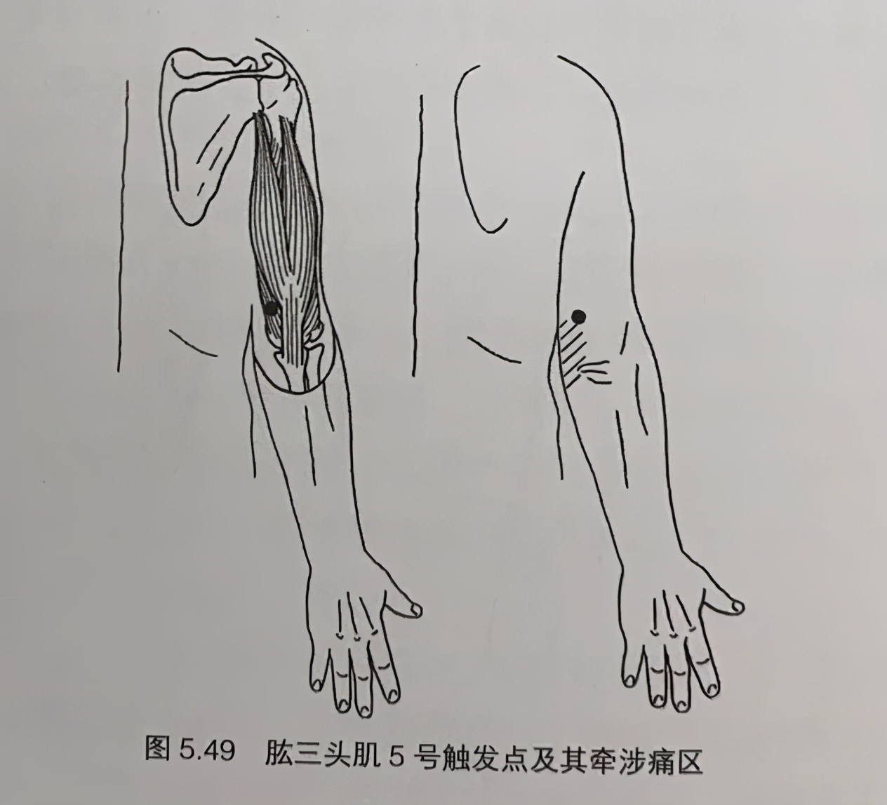 专业解决各种疼痛治疗效果好吗,专业疼痛调理