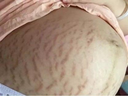 护肤品是不是智商税,孕期气色差买什么护肤品