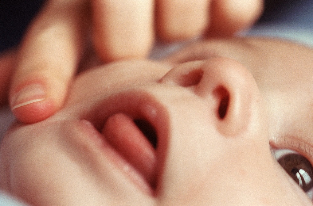 母婴微课堂‖新手爸妈别惊慌，教你搞定鹅口疮！