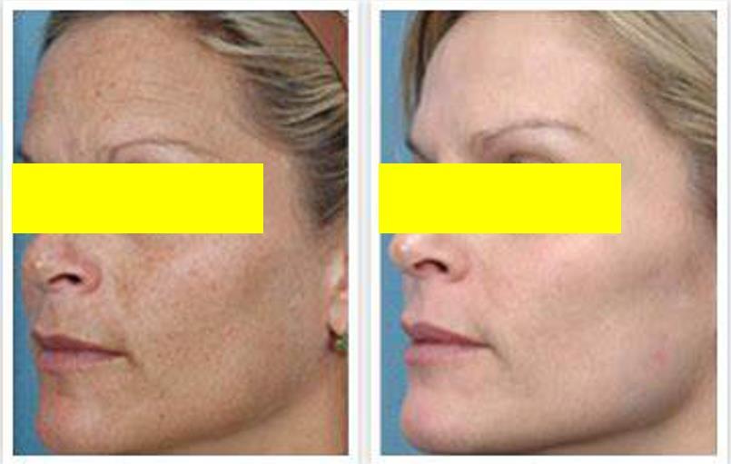 一到夏天皮肤就变黑变黄,夏天容易晒黑修复的水乳