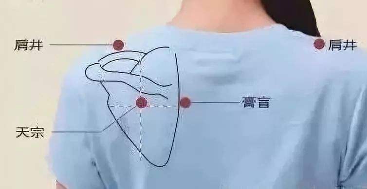 中医针灸治乳腺增生的方法,乳腺增生中医针灸疗法