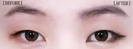 明显双眼皮注意事项,单双眼皮会变成恐怖的阴阳眼吗