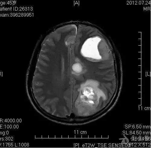 拍了片子拿到结果看不明白？彩虹医生教您看懂影像报告