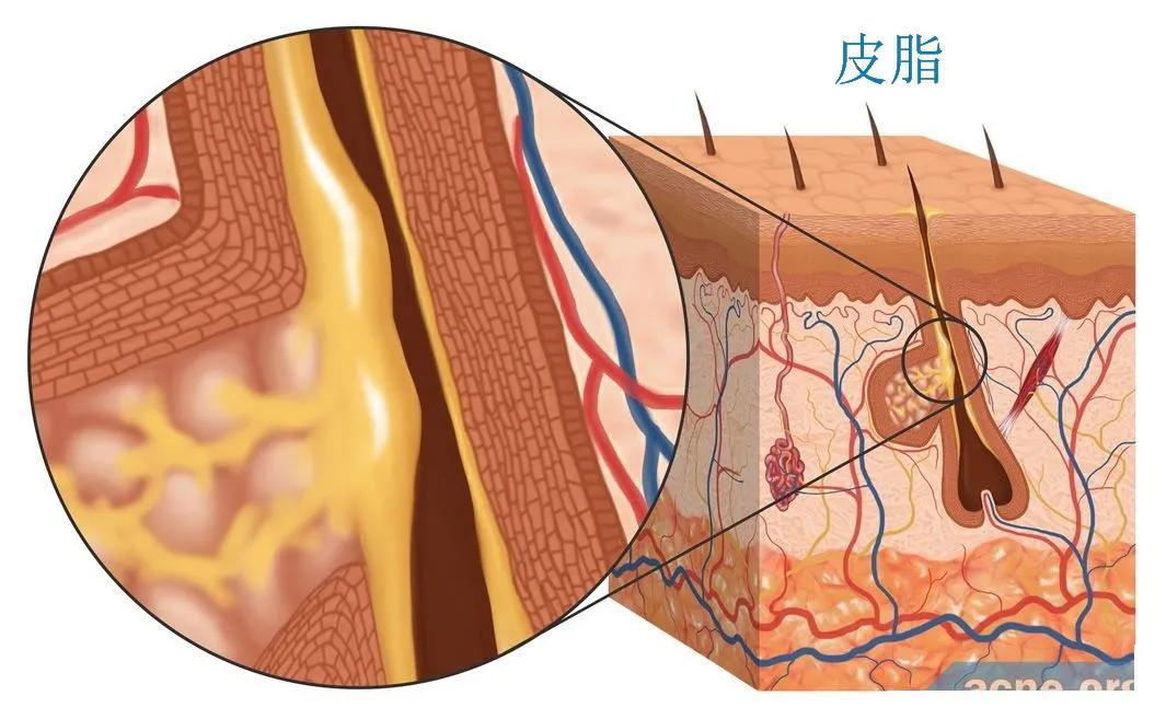 月经前痘痘怎么治,月经期前外阴长痘什么原因