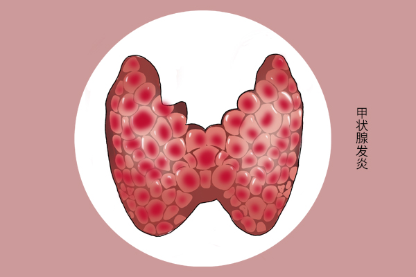 饭后胀气属于哪种胃病,稍微吃多点胃就不舒服是什么情况
