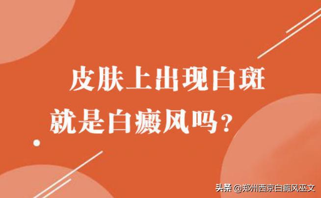 7岁儿童白癜风自愈案例,7岁儿童白癜风治愈经历