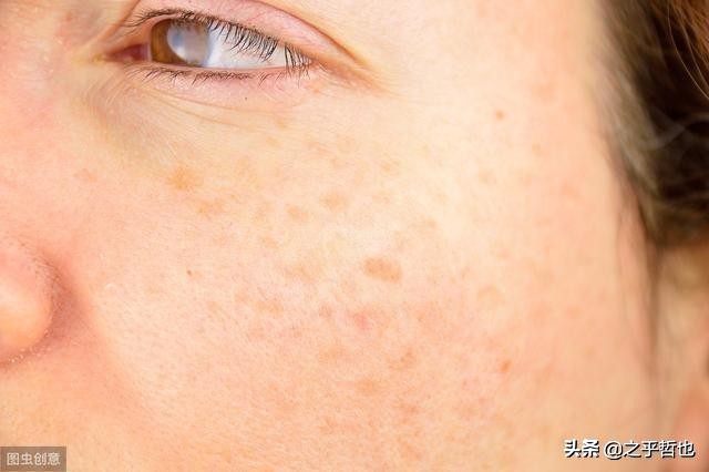 皮肤科医生给的7个护肤建议,皮肤科医生推荐护肤措施