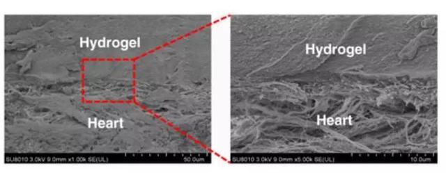 纳米技术让伤口快速愈合的凝胶,神奇胶水60秒缝合伤口