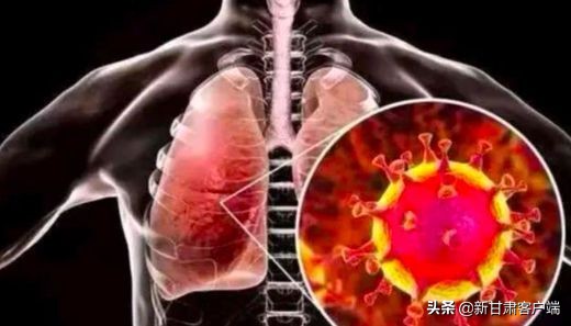 新型冠状病毒可通过气溶胶传播吗 (气溶胶传播病毒专家说法)