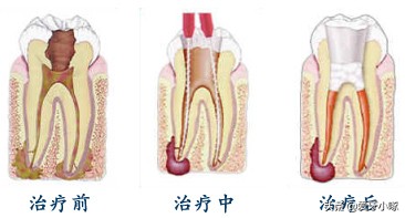 牙齿松动怎么办最有效的方法,牙齿松动怎么办教你一招搞定