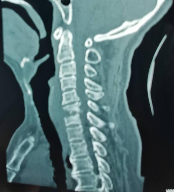 锦州市第二医院骨科,锦州市第二医院脊柱骨科门诊